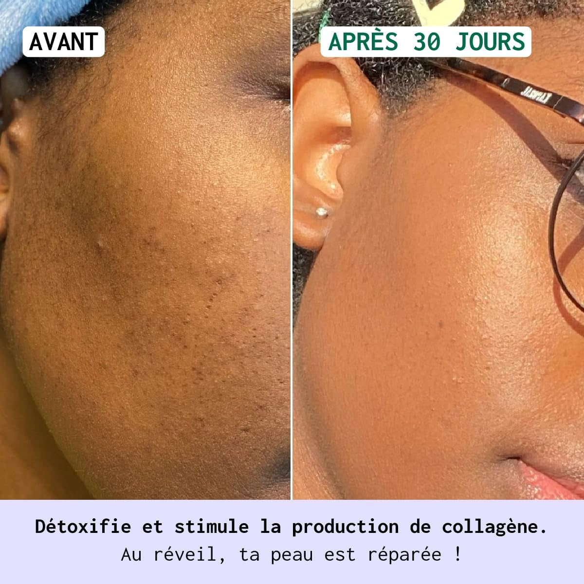 - Crème De Nuit Anti-Taches Visage – Antioxydante - Corrige Les Taches Pigmentaires Et Booste La Production De Collagène – Peaux Noires, Mates Et Métissées – 50Ml